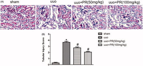 Figure 1. Effects of puerarin treatment in tubular injury after UUO in mouse. (A) Representative photomicrographs of periodic acid-Schiff staining of the four groups: sham, UUO, UUO +50 mg/kg PR, UUO +100 mg/kg PR. (B) Semiquantitative analysis of tubular injury. *p < .05 compared with the sham group; #p < .05 compared with the UUO group (magnification, ×200).