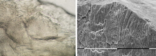Figure 4. Light microscopic view of a ground section of enamel affected by MIH (×40 magnification) and SEM microphotography of enamel affected by MIH. The enamel exhibits disorganized enamel prisms, a porous structure, and loosely packed crystallites. (×40 magnification and ×500).