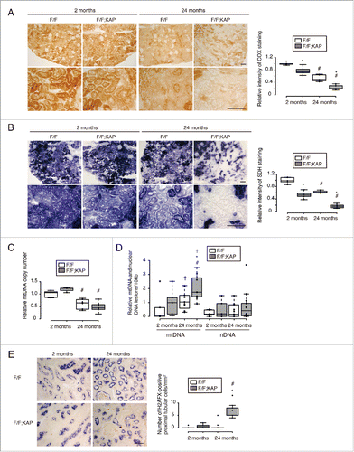 Figure 5. Long-term autophagy deficiency exaggerates mitochondrial dysfunction and mtDNA and nDNA abnormalities. (Aand B) Representative images of COX (A) and SDH (B) staining in the kidney cortical regions of young and aged Atg5F/F and atg5F/F-KAP mice (n = 5 in each group). Bars: 50 μm. The relative staining intensity is shown in the bar graphs. The mean value of young Atg5F/F mice is expressed as 1. (Cand D) Relative mtDNA copy number (C) and relative damage of mtDNA and nDNA (D) are shown. mtDNA and nDNA were extracted from isolated kidney proximal tubules of young or aged Atg5F/F and atg5F/F-KAP mice (n = 7 to 10 in each group). Data are expressed as the fold change relative to the mean value of young Atg5F/F mice (C). (E) Representative images of immunostaining for phospho-H2AFX, a DNA damage marker, in kidney cortical regions of Atg5F/F and atg5F/F-KAP mice (n = 7 to 9 in each group). Bar: 50 μm. Kidney sections were immunostained for the proximal tubule marker LRP2/MEGALIN in blue. The number of phospho-H2AFX-positive proximal tubular cells was counted in at least 10 high-power fields (400). Statistically significant differences (*, P < 0.05 vs. age-matched Atg5F/F control littermates; #, P < 0.05 vs. young mice; †, P < 0.05 mtDNA vs. nDNA) are indicated. F/F, Atg5F/F mice; F/F;KAP, atg5F/F-KAP mice.
