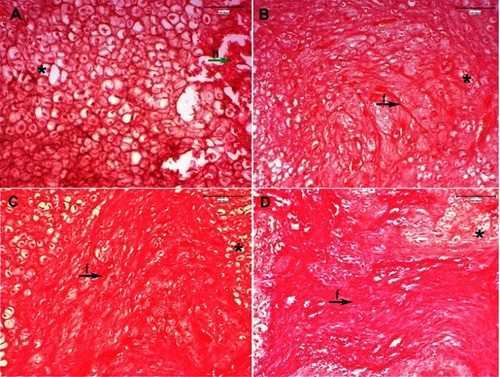 Figure 6 H&E stained at 2 weeks post-surgery, 20× magnification: (A) Control group: persistence of post-fracture hematoma (h) and inflammatory exudation at fracture site (h-green arrow), and numerous large chondrocytes (*), without occurrence of newly synthesized collagen fibers; (B) PESW group: granulation tissue formation with slight inflammatory infiltrate, small chondrocytes gathered in minor clusters (*) and small amount of individual collagen fibers (f-black arrow) among chondrocytes; (C) HAPc group: complete resorption of post-traumatic hematoma and soft callus area formation is well defined by small clusters of grouped chondrocytes (*) separated by well-defined bundle of collagen fibers (f-black arrow) with irregular distribution among chondrocytes; (D) HAPc+PESW group: small islands of grouped chondrocytes (*) and the most advanced stage in synthesis of collagen fibers, assembled in dense, regular, abundant collagen bundles (f-black arrow), as a support for the future bone matrix. Abbreviations: H&E = hematoxylin and eosin; CG = control group; PESW = pulsed electromagnetic short-waves; HAPc = titanium implants coated with multisubstituted hydroxyapatite and collagen; HAPc+PESW = titanium implants coated with multisubstituted hydroxyapatite and collagen and pulsed electromagnetic short-waves.