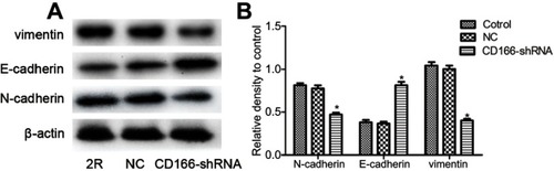 Figure 4 Silencing of CD166 decreased EMT in CNE-2R cells. (A) After CD166 was silenced in CNE-2R cells, E-cadherin was upregulated, and N-cadherin was downregulated as proved by Western blot analysis. (B) Schematical representation of N-cadherin, E-cadherin, and vimentin expression. *P<0.05, the CD166-shRNA group compared with the NC group and control group.