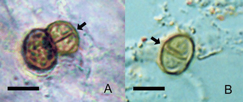Figure 1 Sclerotic cells can be isolated from human lesions and from plants. Typical round, thick-walled, brown color, septated (arrows) sclerotic cells after direct mycological examination from human lesion (A) or from Mimosa pudica thorns (B). scale bars: 10 µm.