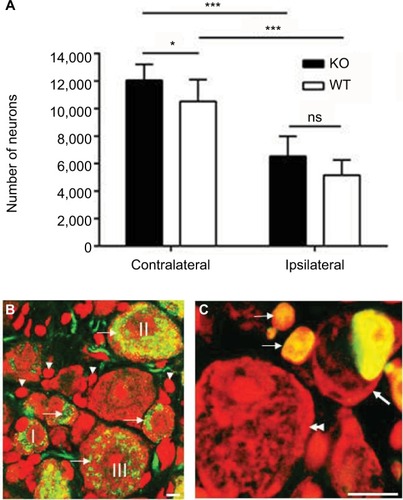 Figure 3 Neuronal number of L5 DRGs 1 month after axotomy.