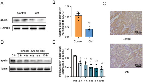 Figure 2. Iohexol intervention reduced apelin expression in tubular epithelial cells in vitro and in vivo. HK-2 cells were treated with iohexol (200 mg iodine/mL) at the indicated time points. The expression of apelin was detected by immunoblot analysis. (A, B) Representative immunoblot analysis and semi-quantitative analysis of apelin in rat kidney tissues, GAPDH was used as a loading control (n = 4). (C) Representative immunohistochemical staining of apelin. Scar bar, 50 μm. (D, E) Representative immunoblot analysis and semi-quantitative analysis of apelin in HK-2 cells. Tubulin was used as a loading control (n = 3). *p < 0.05, **p < 0.01, significantly different from the control group. Data are expressed as means ± SEMs.