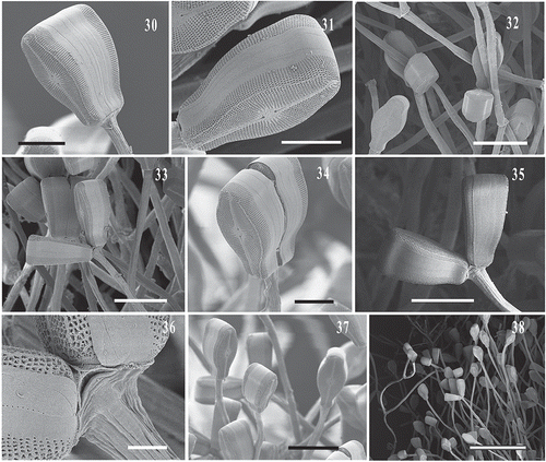 Figs 30–38. SEM images of Didymosphenia hullii on stalks from the West Branch of the Farmington River showing bifurcated stalks with cells attached. Scale bars = 20 µm (Figs 30, 31, 34); 50 µm (Figs 32, 33, 37); 40 µm (Fig. 35); 5 µm (Fig. 36); 200 µm (Fig. 38).