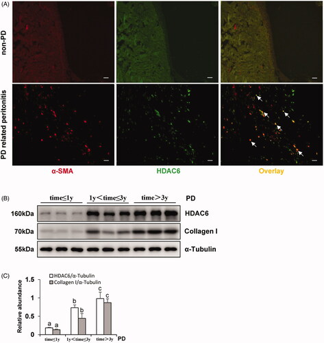 Figure 1. HDAC6 is highly expressed in peritoneum and dialysis effluent from PD patients. (A) Immunofluorescence photomicrographs illustrate co-staining of α-SMA and HDAC6 in the peritoneum from patients with non-PD and PD-related peritonitis. And HDAC6 was co-expressed with α-SMA-positive cells (white arrows). (B) Human PD effluents were subjected to immunoblot analysis with antibodies against HDAC6, Collagen I and α-Tubulin. (C) Expression levels of HDAC6 and Collagen I were quantified by densitometry and normalized with α-Tubulin. Data are represented as the mean ± SEM. Means with different superscript letters are significantly different from one another (p < 0.05). All scale bars = 20 μm.