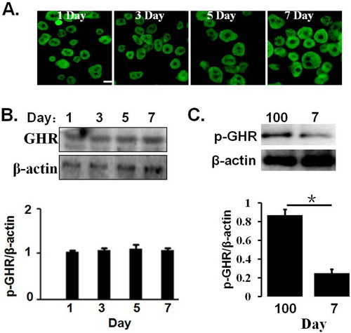 Figure 1. (A) pGHR expression on the hepatocytes from 1 to 7 days old and 100 days old pig. The freshly isolated hepatocytes were pre-treated, as described as in materials and methods. The cells were then incubated with anti-pGHR antibody. After washing three times, the cells were treated with FITC-labeled secondary antibody. Bar: 10 μm. (B) Characterization of pGHR expression by Western blot. The cell extracts from porcine hepatocytes were subjected to immunoblotting with anti-pGHR antibody. After incubation with secondary antibody at room temperature, the immunoreactive bands were detected using an ECL-plus kit. (C) Comparison of pGHR expression between 100 days old pig and 7 days old pig. Data are shown as the mean ± SE. Significant differences are marked with an asterisk. The figure is representative of three independent experiments.