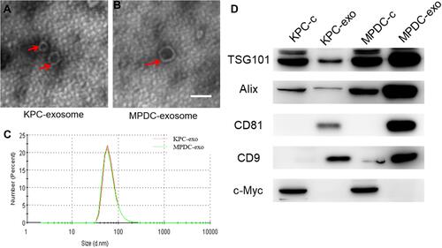 Figure 1 Characterization of exosomes derived from different cells. (A and B) Typical transmission electron microscopy (TEM) images of KPC-exosomes (A), MPDC-exosomes (B), scale bar, 100 nm; (C) size distributions of EVs isolated from different cells; (D) levels of exosomal marker proteins TSG101, Alix, CD81 and CD9 in cell lysates and microvesicles were determined using Western blot. C-myc was selected as the negative marker.