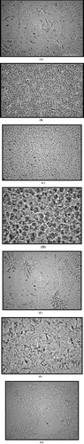 FIG. 1 Photomicrographs showing microstructures of different gels. (A) Span60/Tween60; (B) Span60/Tween20; (C) Span40/Tween80; (D) Span40/Labrasol; (E) GMS/Tween60; (F) GMS/Labrasol; (G) Span40/Tween20.