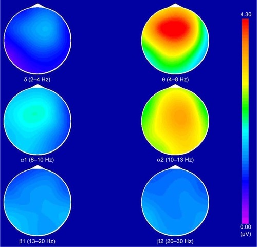 Figure 2 The brain electrical activity mapping (BEAM) of chronic fatigue syndrome patients.