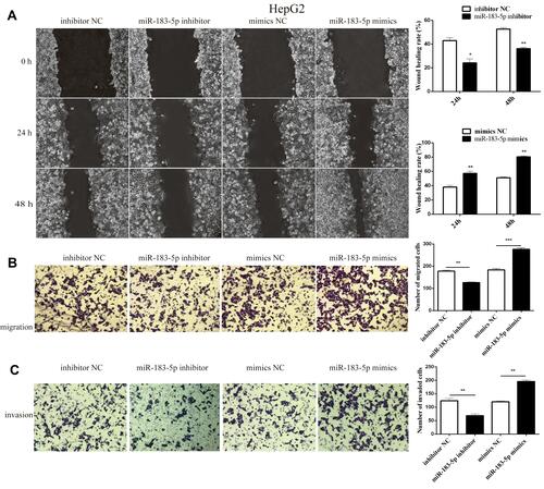 Figure 2 Effect of migration and invasion in HepG2 cells after transfection with miR-183-5p inhibitor.