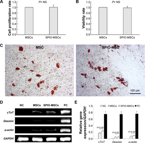 Figure 3 Proliferation, viability, and differentiation capacity of SPIO-MSCs.Notes: (A) Proliferation rate of SPIO-MSCs. (B) Viability rate of SPIO-MSCs. (C) Oil red O staining for adipogenic differentiation (both images in C are at 100 μm in size range). (D) RT-PCR for myocardial gene cTnT, Desmin, and α-cardiac actin. (E) Quantitative gene expression analysis. SPIO labeling did not affect the proliferation, viability, and differentiation capacity of MSCs.Abbreviations: MSCs, mesenchymal stem cells; SPIO, superparamagnetic iron oxide; SPIO-MSCs, mesenchymal stem cells incubated with superparamagnetic iron oxide; RT-PCR, real-time quantitative polymerase chain reaction; GAPDH, glyceraldehyde 3-phosphate dehydrogenase; NS, not significant; NC, negative control; PC, positive control.