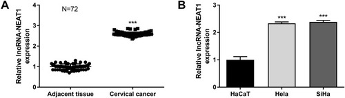 Figure 1 The expression of lncRNA-NEAT1 was upregulated in CC tissues and cells (HeLa and SiHa cells). (A) The expression of lncRNA-NEAT1 in CC tissues and adjacent tissues (N = 72) was detected by qRT-PCR. (B) The expression of lncRNA-NEAT1 in HaCaT, HeLa and SiHa cells was detected by qRT-PCR. Data were presented as mean ± standard deviation with three replicates. ***P < 0.001, vs. adjacent tissues (A) and HaCaT cells (B).