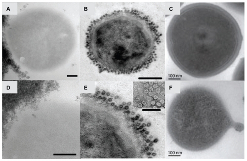 Figure 3 Transmission electron micrographs of Staphylococcus aureus bacteria interacting with nanoparticles including superparamagnetic iron oxide nanoparticles (A and D), cowpea chlorotic mottle virus (CCMV) nanoparticles (B and E), and self-assembled cationic peptide nanoparticles (C and F). Magnetic nanoparticles bind to the bacterial cell surface resulting in membrane disruption (A) and nanoparticle penetration (D) potentially used for bacterial separations. CCMV binds to a coating of protein A antibodies on S. aureus membranes through biotin–streptavidin interactions (B) without penetration (E; inset: close-up view of the coated surface) for targeting of magnetic resonance imaging contrast agents.Citation40 S. aureus before (C) and after (F) membrane disruption by self-assembled cationic peptide nanoparticles, leading to a rough surface and the formation of a minicell.Citation41Note: Scale bars: A, C–F, 100 nm; B, 200 nm. B and E are reprinted from Chemistry and Biology, 14/4, Suci PA, Berglund DL, Liepold L, et al, High-density targeting of a viral multifunctional nanoplatform to a pathogenic, biofilm-forming bacterium, 387–398, 2007, with permission from Elsevier. C and F are reproduced from Liu et al with permission from the publisher.Citation41