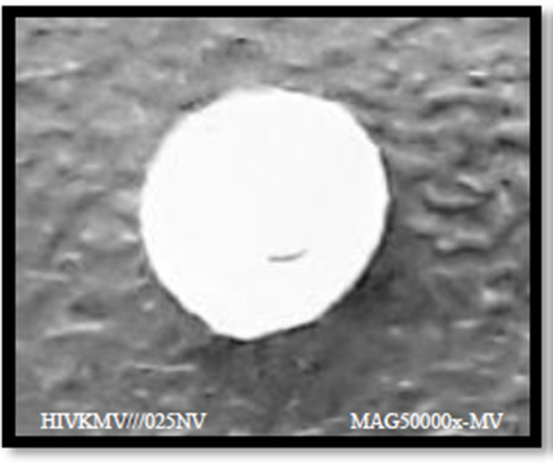 Figure 5 Scanning image of F13 microsphere formula.