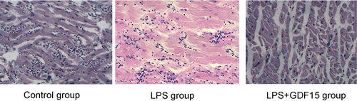 Figure 10. Cardiac pathology of mice in each group (H&E, × 400).