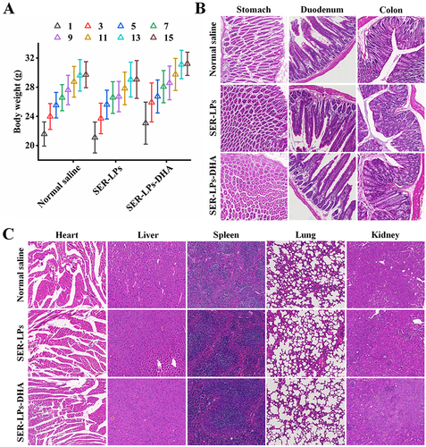 Figure 9 In vivo safety evaluation of SER-LPs and SER-LPs-DHA.