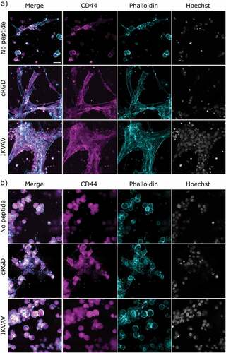 Figure 6. Confocal images of encapsulated FPA (a) and U87 (b) in respective hydrogels after 6 days. FPA and U87 are stained with HA receptor CD44 (magenta), cytoskeletal F-actin marker Phalloidin (cyan), and nuclear stain Hoechst (gray). 80 000 cells were seeded per hydrogel and for this analysis, six hydrogel replicates per condition were imaged at four sites per hydrogel. Scale bar: 30 μm.