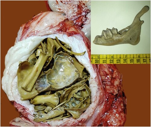 Figure 1. Sectioned uterus with fetal bones found, and details of the mandible showing the three cusps of the erupted third premolar.