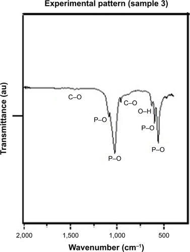 Figure 4 IR spectrum of the synthesized HA.Abbreviations: IR, infrared; HA, hydroxyapatite.