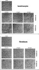 Figure 5 Morphological changes in keratinocyte and fibroblast cells incubated with different concentrations (0.3 mg/mL, 1.5 mg/mL and 3.0 mg/mL) of 2nd and 3rd generation PAMAM dendrimers for 24 h exposure. Representative photographs are shown. Morphological effects evaluated by phase contrast microscopy (magnification × 100).