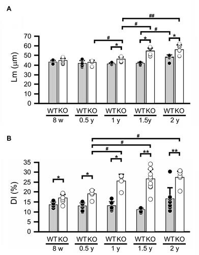 Figure 3 Lm and DI in lung tissues during aging. (A) Mean linear intercept (Lm) in wild-type (WT) and Secretoglobin (Scgb) 3a2-knockout (KO) mouse lungs from 8 weeks (8 w) to 2 years of age (2 y). Lm of WT significantly increased in 2-year-old (2 y) in WT mice, whereas that in KO mice gradually increased after 1 year (1 y), being significantly larger than that in WT. (B) Destructive index (DI) in wild-type and Scgb3a2-KO mouse lungs from 8 w to 2 y. DI was constant regardless of age in WT mice, and after 1 year of age (1 y) in KO mice. Filled columns and black dots: WT; open columns and white dots: KO; N=5-9. Specifically, the number of mice analyzed were as follows: WT [8w: 3 males (m), 2 females (f); 0.5y: 4m, 4f; 1y: 3m, 2f; 1.5y: 5f; 2y: 3m, 5f] and KO (8w: 4m, 3f; 0.5y: 3m, 4f; 1y: 2m, 2f; 1.5y: 5m, 4f; 2y: 3m, 3f). Because Lm and DI did not apparently differ between male and female mice, the results were combined. Data are presented as the mean ± standard deviation (SD). Statistical differences between ages in the same strain were analyzed by one-way analysis of variance (ANOVA), followed by the Tukey–Kramer post hoc test (#p < 0.05, ##p < 0.01). Differences between different strains at the same age were analyzed using Student’s t-test (*p < 0.05, **p < 0.01).