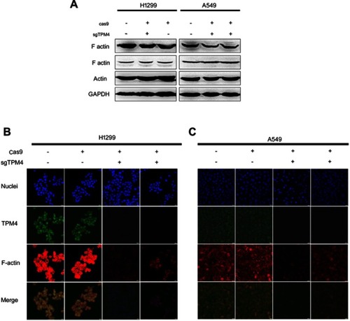 Figure 3 Downregulation of TPM4 led to disruption of actin organization. (A) F-actin expression level was detected by WB. The actin level was also determined as a control, with GADPH used as the internal loading controls. (B, C) F-actin and TPM4 were labeled by immunofluorescence staining. The red signal represents the staining of F-actin, the green signal represents the staining of TPM4, and the blue signal represents the nuclear DNA staining by Hoechst 33342. Bars represent 20 μm.Abbreviation: WB, Western blot.