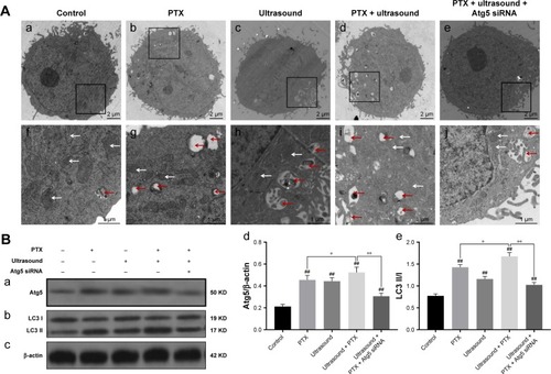 Figure 1 Effect of ultrasound treatment on autophagy in PTX-resistant PC-3 cells.