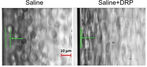 Figure 1 Effect of drag-reducing polymer (DRP) on cell-free layer near vessel wall.