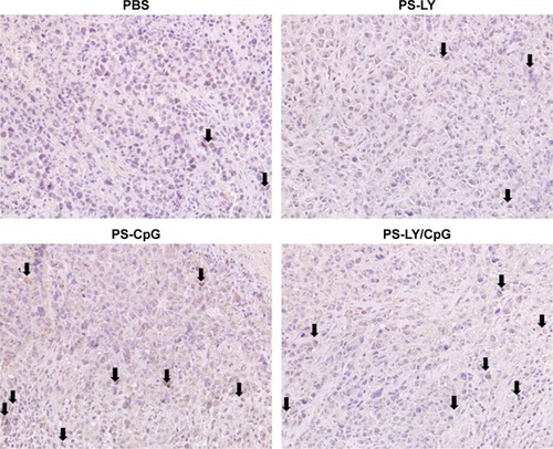 Figure 5 Immunohistochemistry staining of CD8+ T-cells in tumor tissues.Note: CD8+ T-cells (arrows) increased in the PS-CpG group and the PS-LY/CpG group through immunohistochemistry analysis.Abbreviations: PS, polyethylenimine-modified carboxyl-styrene/acrylamide; LY, LY215729; CpG, cytosine-phosphate-guanine; PBS, phosphate-buffered saline.