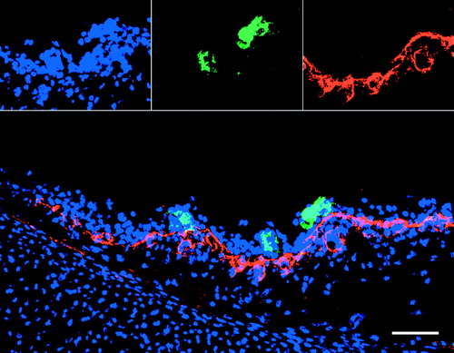Figure 1. Representative confocal photomicrographs illustrating three ILTV-positive plaques in the epithelium of tracheal mucosa at 24 h p.i. Images for individual channels are shown on the top row from left to right (blue fluorescence, cell nuclei; green fluorescence, ILTV antigen; red fluorescence, collagen IV). A larger merged image is shown below. Colocalization of viral antigen with collagen IV, if present, would be visualized by a yellow colour. Scale bar = 50 µm.