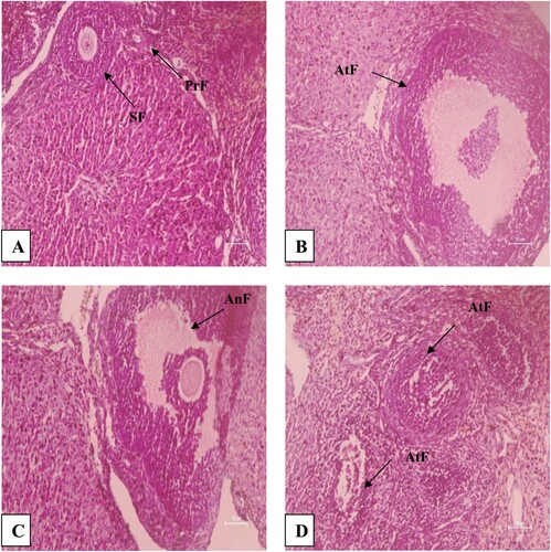 Figure 4. H&E stained sections of the ovary of B. bengalensis treated with different concentrations of papaya seed powder and sacrificed immediately after the withdrawal at 200× magnification showing the effect on follicular development, (A) control rat, (B) 3% treated rat, (C) 5% treated rat, and (D) 10% treated rat (PrF-Primordial follicle, SF-Secondary normal follicle, AnF-Antral follicle, AtF-Atretic follicle).