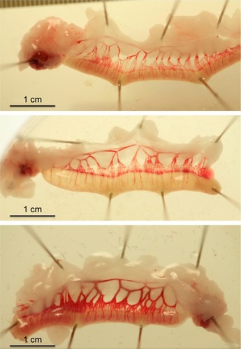 Figure 2 Uterine horns freshly dissected from non-pregnant rats at 13 days (six days after seven-day exposure to reagent release from the inserted osmotic pumps). Top: saline treated animal; middle: His-PP13 treated animal; bottom: rPP13 treated animal.