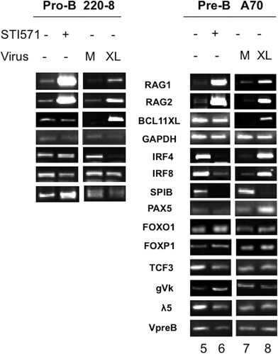 FIG 7 Comparison of BCL11A-XL overexpression levels following induction of V(D)J recombination-associated genes and following isolation of RNA from lymphoid cell types. Pro-B (220-8) (left) and pre-B (A70) (right) cell lines were either treated with STI571 (3 μM for 20 h) or stably transduced with BCL11A-XL (XL) or empty virus (M) as described in the legend to Fig. 4 and then subjected to semiquantitative RT-PCR analysis. cDNAs were amplified under linear conditions, gel fractionated, and visualized by ethidium bromide staining. GAPDH was the loading control.