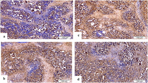 Figure 14. Sections of Ehrlich solid tumour tissue immunohistochemically labelled for caspase-3 (×200). (a) Untreated control lacking detectable antibody for caspase-3. (b) DOX with positive caspase3 immunoreactivity. (c) 8b exhibited significant positive expression of caspase-3 by the immune system. (d) 3b displayed positive caspase-3 immunoreactivity.