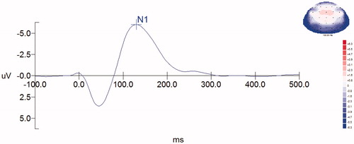 Figure 4. The 2D map of the scalp current density of N1.