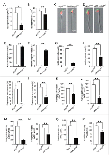 Figure 2. The disruption of autophagy in Sertoli cells produces spermatozoa with malformed heads and low motility. (A-B) The total number of spermatozoa from the cauda epididymis was decreased in AMH-atg5−/−and AMH-atg7−/−mice. Atg5Flox/Flox (white column), 19.93 ± 3.69 × 106; AMH-atg5−/− (black column), 5.37 ± 2.84 × 106 in (A). Atg7Flox/Flox (white column), 21.70 ± 0.25 × 106; AMH-atg7−/− (black column), 17.74 ± 0.53 × 106in (B). (C-D) The sperm nuclear morphology and acrosomes are malformed in AMH-atg5−/−and AMH-atg7−/−mice. The single-sperm immunofluorescence analysis for the acrosome-specific marker ZP3R (green) was performed using Atg5Flox/Flox(left panel) and AMH-atg5−/−(right panel) spermatozoa in (C), and Atg7Flox/Flox(left panel) and AMH-atg7−/−(right panel) spermatozoa in (D). Nuclei were stained with PI (red). (E-F) The abnormal sperm rate was increased in AMH-atg5−/−and AMH-atg7−/−mice. In AMH-atg5−/− mice (black column), 46.13 ± 0.93% of sperm had malformed heads, whereas only 3.44 ± 0.34% of Atg5Flox/Flox mice (white column) had malformed heads (E). In AMH-atg7−/− mice (black column), 29.97 ± 1.69% of sperm had malformed heads, whereas only 1.97 ± 0.28% of Atg7Flox/Flox mice (white column) did (F). (G-H) The motile sperm rate was decreased in AMH-atg5−/−and AMH-atg7−/−mice. Atg5Flox/Flox (white column, 88.00 ± 1.83%), AMH-atg5−/−(black column, 15.00 ± 1.83%) (G). Atg7Flox/Flox(white column, 88.33 ± 3.84%), AMH-atg7−/−(black column, 44.67 ± 2.40%) (H). (I-J) The progressive sperm rate was decreased in AMH-atg5−/−and AMH-atg7−/−mice. Atg5Flox/Flox (white column, 24.00 ± 6.58%), AMH-atg5−/−(black column, 0.50 ± 0.71%) (I). Atg7Flox/Flox (white column, 23.67 ± 1.76%), AMH-atg7−/−(black column, 9.33 ± 2.85%) (J). (K-L) The average path velocity (VAP) of the spermatozoa was decreased in AMH-atg5−/−and AMH-atg7−/−mice. Atg5Flox/Flox (white column, 115.48 ± 15.75 μm/s), AMH-atg5−/−(black column, 34.18 ± 12.82 μm/s) (K). Atg7Flox/Flox (white column, 93.00 ± 8.20 μm/s), AMH-atg7−/−(black column, 57.97 ± 6.42 μm/s) (L). (M-N) The straight-line velocity (VSL) of the spermatozoa was decreased in AMH-atg5−/−and AMH-atg7−/−mice. Atg5Flox/Flox (white column, 78.90 ± 14.65 μm/s), AMH-atg5−/−(black column, 18.18 ± 4.82 μm/s) (M). Atg7Flox/Flox (white column, 64.07 ± 4.89 μm/s), AMH-atg7−/−(black column, 38.50 ± 2.57 μm/s) (N). (O-P) The curvilinear velocity (VCL) of the spermatozoa was decreased in AMH-atg5−/−and AMH-atg7−/−mice. Atg5Flox/Flox (white column, 191.93 ± 25.16 μm/s), AMH-atg5−/−(black column, 64.48 ± 14.22 μm/s) (O). Atg7Flox/Flox (white column, 156.87± 9.44 μm/s), AMH-atg7−/−(black column, 104.33 ± 13 μm/s) (P). See also Figure S3.