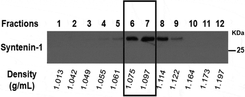 Figure 2. Representative example of the 12 fractions obtained by OptiPrepTM density gradient. Fractions were weight scaled for density evaluation and syntenin-1 expression was assessed. Fractions 6 and 7 showed a density of approximately 1.1 g/mL and the highest expression of syntenin-1 extracellular vesicle marker.