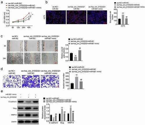 Figure 4. miR-661 partially reversed hsa_circ_0103232 promoting effect on melanoma cells proliferation, migration, invasion and EMT. (a) CCK-8 assay illustrated that miR-661 partially reversed hsa_circ_0103232 promoting effect on melanoma cells viability. (b) Edu experiment revealed miR-661 partially reversed hsa_circ_0103232 promoting effect on melanoma cells proliferation. (c) Wound healing assay indicated that miR-661 partially reversed hsa_circ_0103232 promoting effect on melanoma cells migration. (d) Transwell experiment demonstrated that miR-661 partially reversed hsa_circ_0103232 promoting effect on melanoma cells invasion. (e) Western blot reveal that miR-661 partially reversed hsa_circ_0103232 promoting effect on melanoma cells EMT. ** P < 0.01 compared with oe-NC + miR-NC group. ## P < 0.01 compared with oe-hsa_circ_0103232 + miR-NC group.