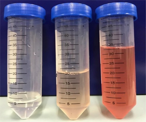 Figure 3 The bronchoalveolar lavage fluid gradually became bloody from the left tube to the right tube.