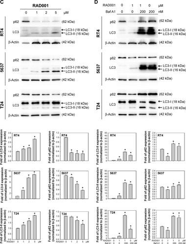 Figure 3 RAD001 induces autophagy in human bladder cancer cells.