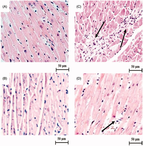 Figure 5. Effect of LU on cardiac histological changes under a light microscope (400×). The cardiac section of control rats (A) and LU alone rats (B) showed normal cardiac architecture with a proper myofibrillar arrangement without any abnormal histopathological changes. While the cardiac section of ISO-induced rats (C) depict disoriented myofibril with intense neutrophil infiltration (arrow mark) and many necrotic changes. The cardiac section of rats pre-treated with LU (D) before ISO-induced display mild neutrophil infiltration (arrow mark) and lesser necrotic changes with a better myofibrillar arrangement. Scale bar: 50 µm.