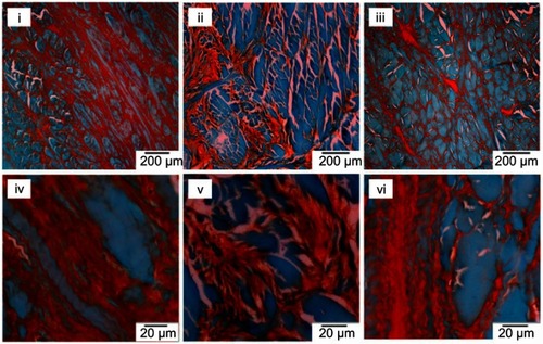 Figure 6 Safranin O/fast green staining of native (i, iv), immersed scaffolds (ii, v) and sonicated scaffolds (iii, vi) with a magnification of 4× (i, ii, iii) and 40× (iv,v,vi).