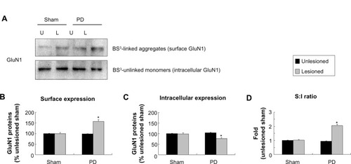 Figure 4 Effect of 6-OHDA lesions on GluN1 receptor expression in surface and intracellular pools of rat striatum.