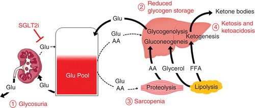 Figure 2. A hypothetical model of possible adverse events and underlying mechanisms associated with chronic use of sodium/glucose co-transporter 2 inhibitors. Glycosuria by sodium/glucose co-transporter 2 (SGLT2i) increases risk of urogenital infections as well as dehydration due to osmotic diuresis (1. Glycosuria). In response to urinary loss of glucose by SGLT2i, insulin levels are reduced and glucagon levels are elevated. Reduced insulin limits uptake of glucose and amino acids into liver and muscle. Elevated glucagon enhances gluconeogenesis and glycogenolysis in liver, proteolysis in muscle and lipolysis in adipose tissues. When patients with non-obese type 2 diabetes inappropriately restrict dietary carbohydrate intake along with their SGLT2i use, hepatic glycogen storage might become depleted due to reduced glucose uptake and enhanced glucogenolysis, making the patient prone to severe hypoglycemia (2. Reduced glycogen storage). Diabetes-associated sarcopenia could be accelerated as the reduced insulin restricts uptake of glucose and amino acids into muscle, and the elevated glucagon enhances proteolysis (3. Sarcopenia). Lipolysis could be enhanced by elevated glucagon, and the release free fatty acids converted into ketone bodies, which might result in ketosis or ketoacidosis (4. Ketosis and ketoacidosis).