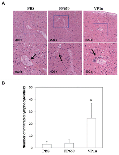 Figure 2. Histopathological analysis of hepatic tissue sections with hematoxylin and eosin staining. Livers from BALB/c mice receiving COS-7 cells without tranfection, COS-7 cells transfected with pTurboFP650, and COS-7 cells transfected with pTurboFP650-VP1u are shown were analyzed with hematoxylin and eosin staining. These images of hepatic sections were magnified by 200 times. Amplified images were shown in the right panel and the lymphocyte infiltration was indicated by an arrow. Similar results were observed in 3 independent experiments.