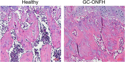 Figure 1 Histological analysis of paraffin sections of the femoral heads. Representative images of H&E‑stained coronal sections of femoral heads in healthy and model group. The necrotic area, including karyolysis, karyorrhectic osteocytes, marrow necrosis and fibrous invasion, was evident in the model group.