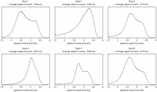 Figure 8. Speed of sound histograms for each skull, with a maximum speed set to 4000 m/s.