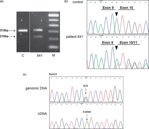 Figure 1.  Characterization of variant MLH1,c.884 + 4A > G. a. Agarose gel showing RT-PCR products obtained in cDNA of index patient 841 and a control (C) by use of a forward primer in exon 8 and a reverse primer in exon 11 of the MLH1 gene. An additional 219 bp fragment due to a deletion of exon 10 was observed in patient 841. DNA ladder with a spacing of 100bp (M). b. Sequencing pattern of the exon 9 – exon 10/11 junction of RT-PCR products of patient 841 showing skipping of exon 10. c. The full-length RT-PCR product of patient 841 contained only one allele (A) at nucleotide position 655, suggesting the complete skipping of exon 10 in one allele due to the intronic mutation.
