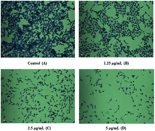 Figure 3. Inverted microscopy results show the potential effect of CeO2-NCs by crystal violet staining. (A) No significant effects were observed on untreated HT29 cells (control). (B–D) HT29 cells were treated with different concentrations of CeO2-NCs. Alterations in morphology and reductions in cell number indicate the activity of CeO2-NCs. Bars = 10 μm.